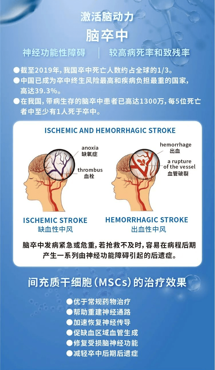 大幅降温一定要警惕卒中