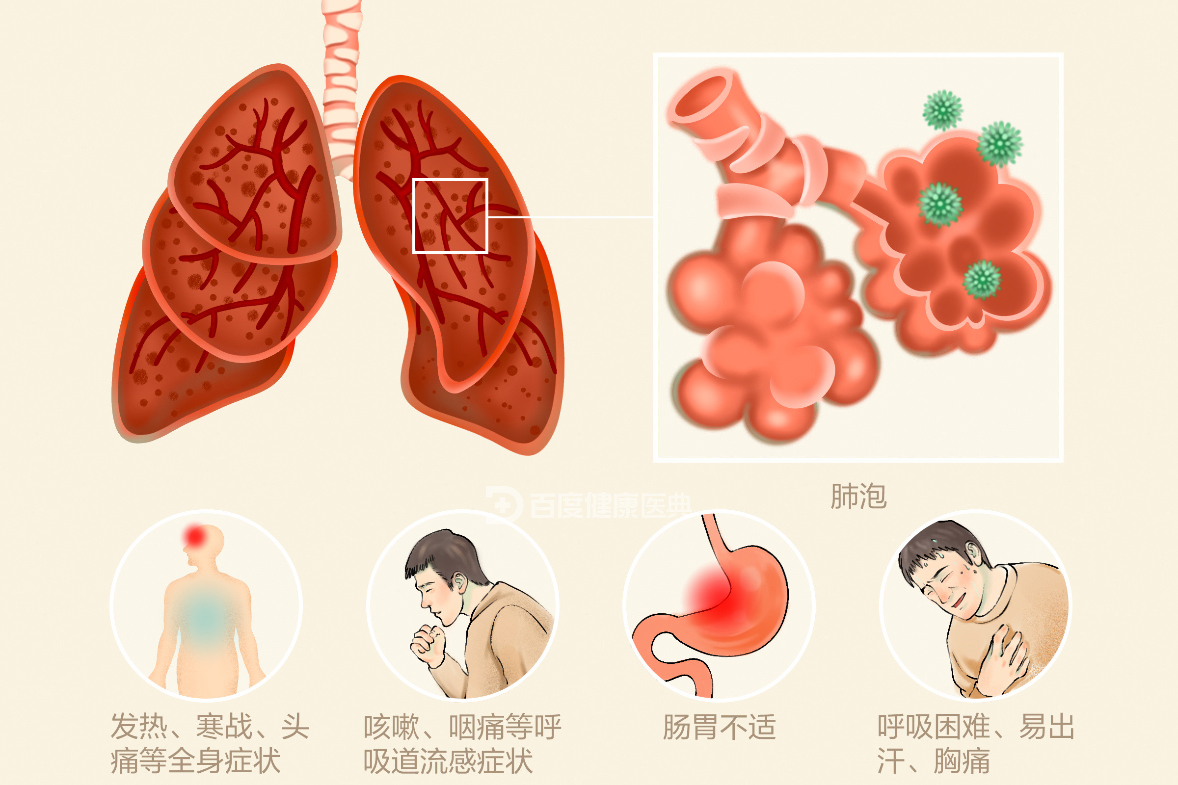 3岁女孩同时感染5种病原体