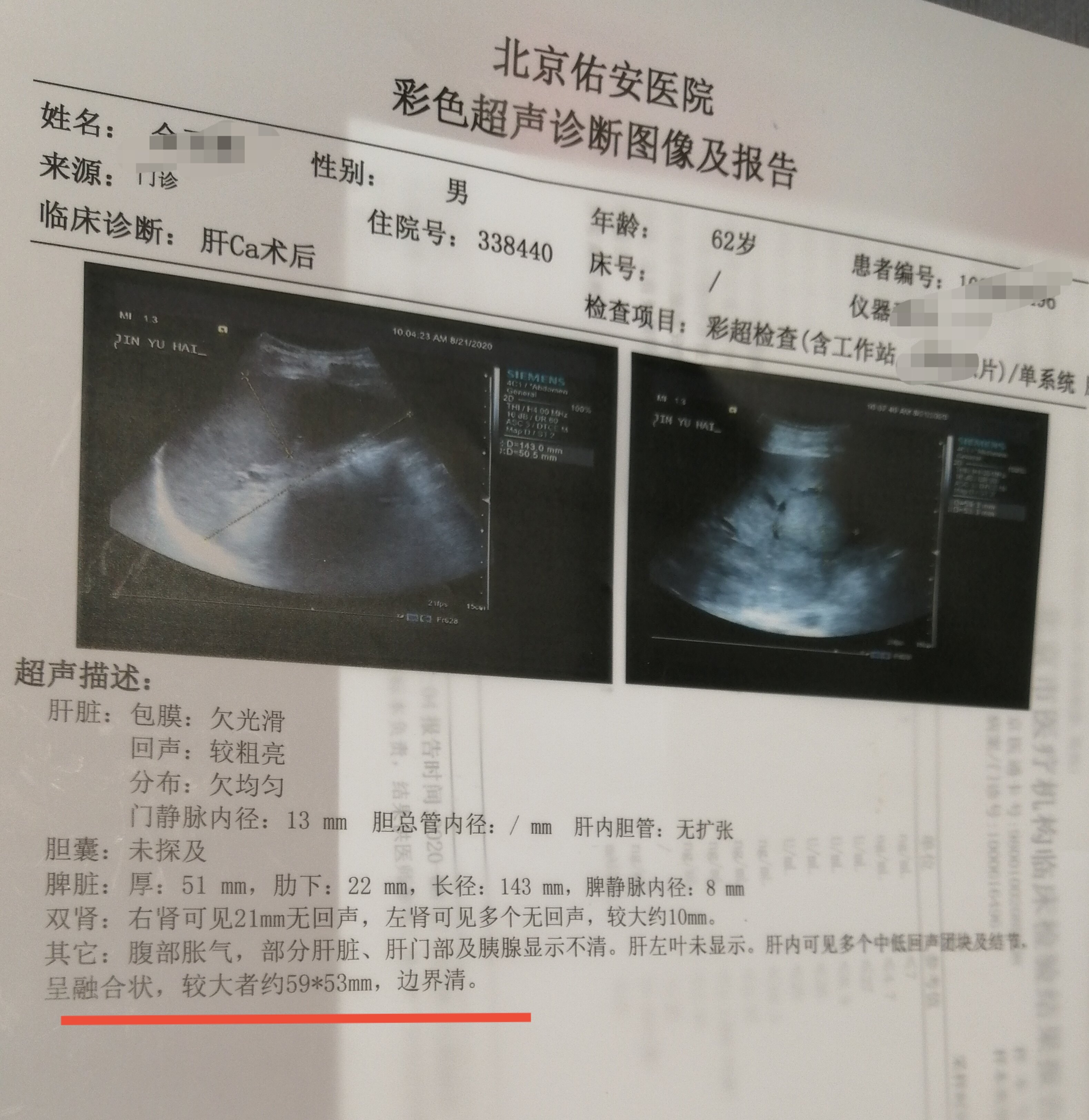 重庆男子狂奔9小时逃出缅北