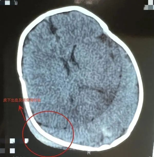 事发上海，家长抱娃坐副驾驶，遇车祸幼童瞬间被甩出不幸身亡