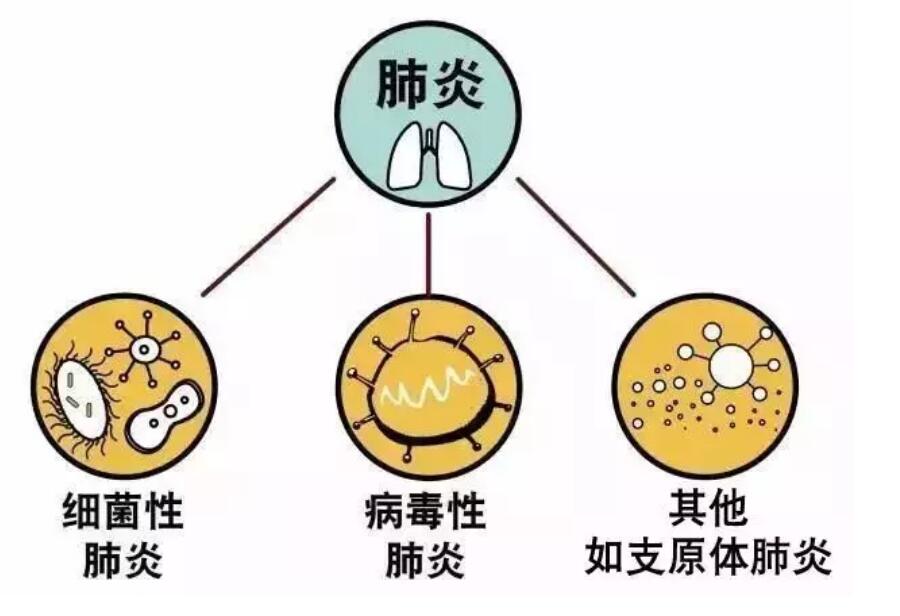 支原体肺炎什么情况需要就医